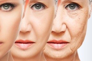 Mimik Kırışıklıkları?